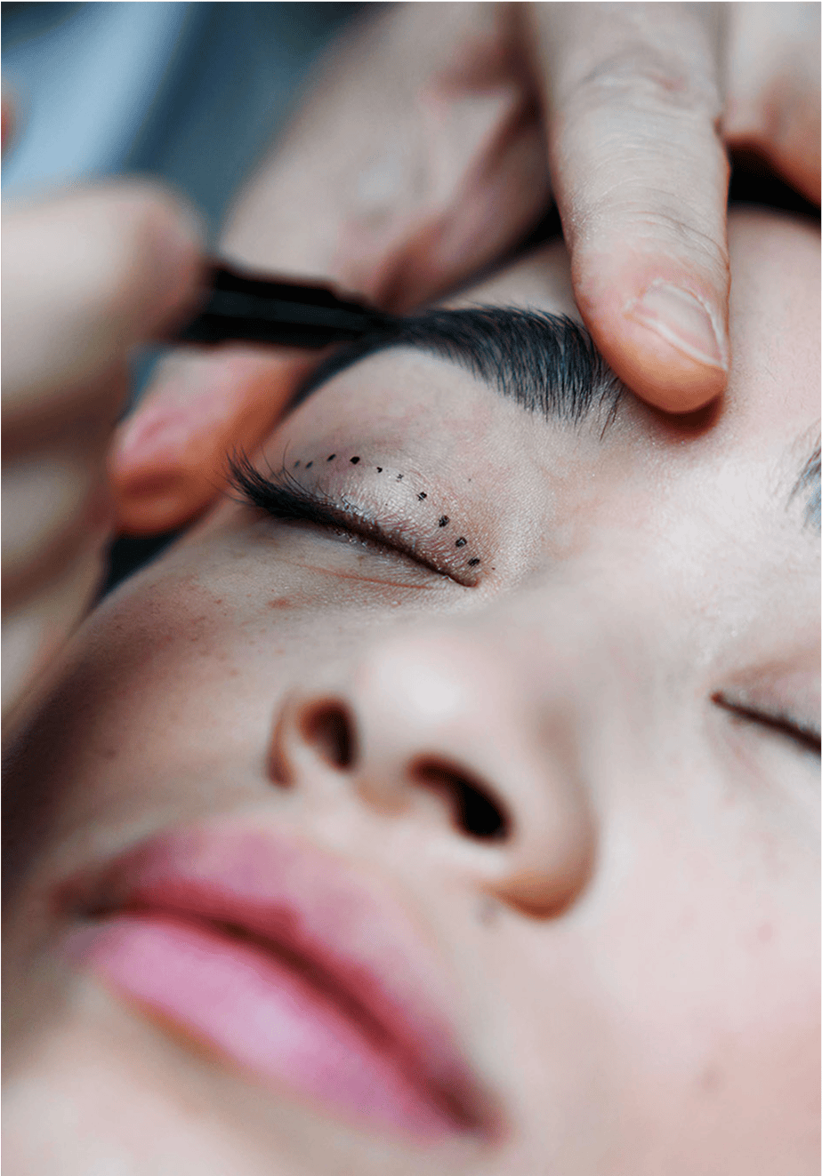 botox marking Botox Chicago