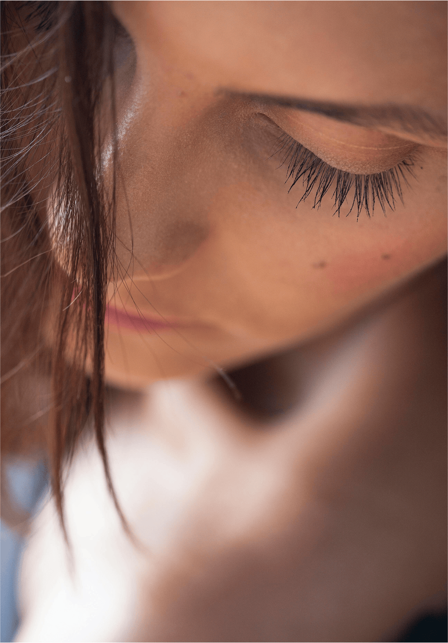 botox treatment image 2